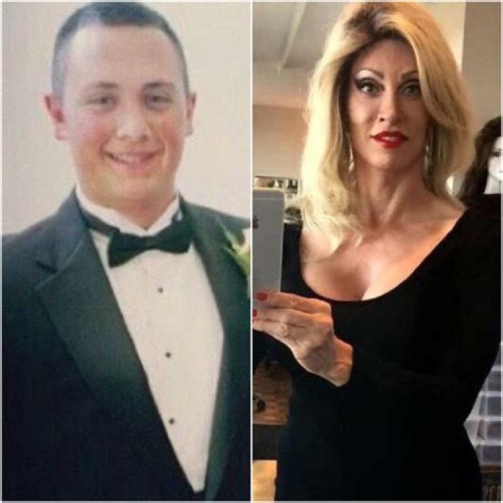 Blair White's Transformation: Before Surgery