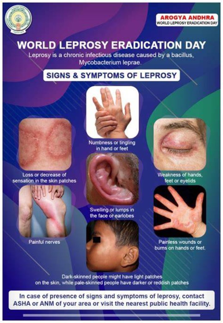 How long does it take for leprosy symptoms to show?