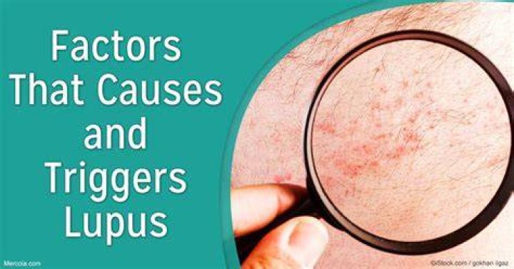What can trigger lupus?
