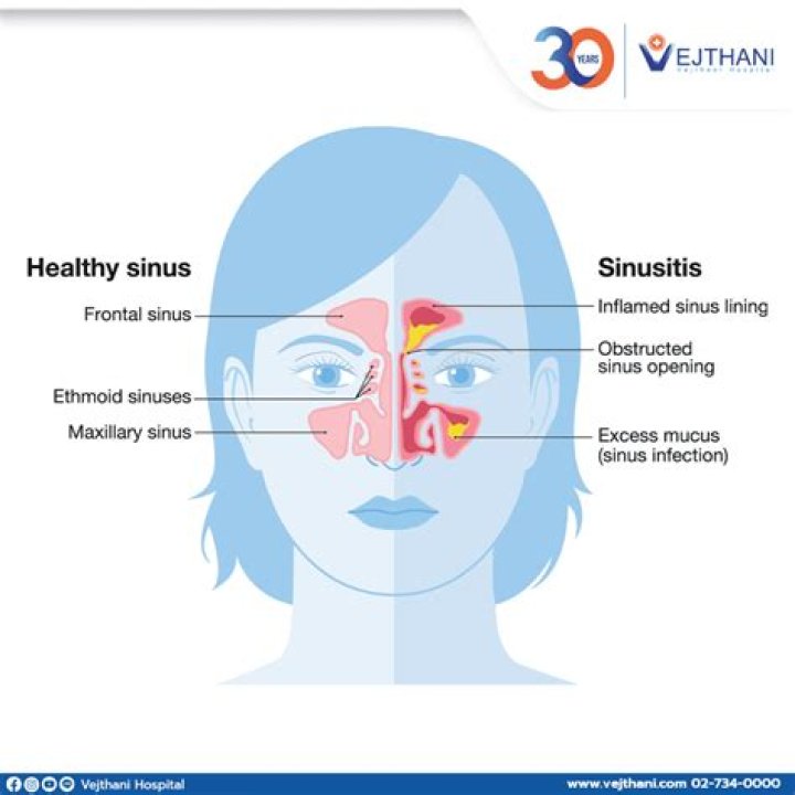 What happens if chronic sinusitis goes untreated?