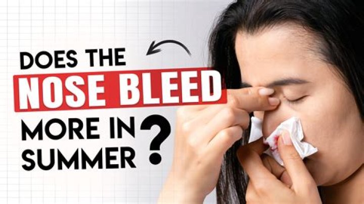 Why does my nose only bleed on one side?